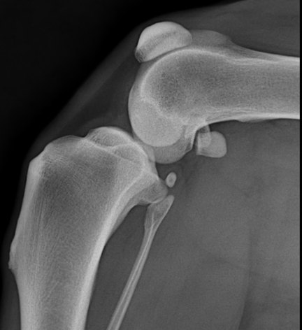 Side-view X-ray of a normal dog knee: the fat pad behind the patellar ligament forms a clearly defined dark area
