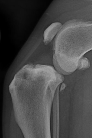 Side-view X-ray of a dog's knee: the tibial plateau has shifted forward relative to the femoral condyles