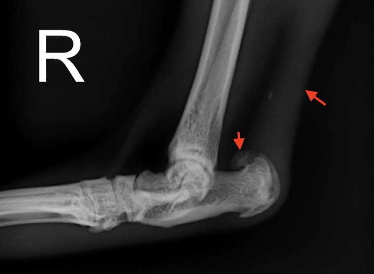 Radiographie de profil du tarse d'un chien, les flèches rouges indiquant la zone lésée